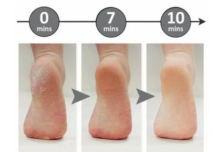 Pulidor de pies anticallos